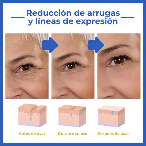 REJUVE21™ - Suero Antiarrugas