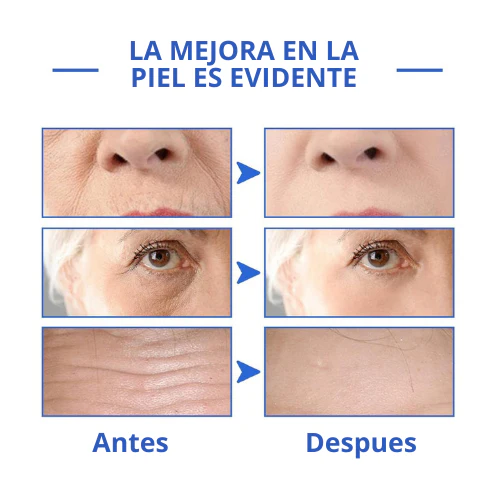REJUVE21™ - Suero Antiarrugas