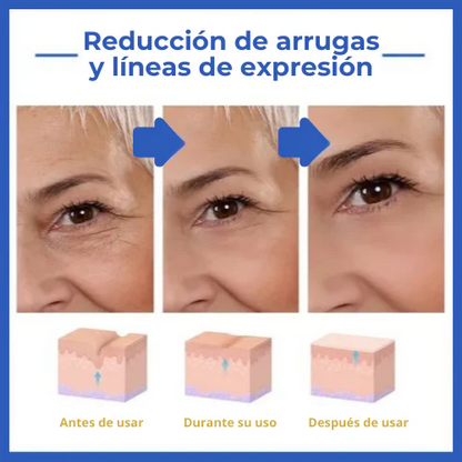 REJUVE21™ - Suero Antiarrugas