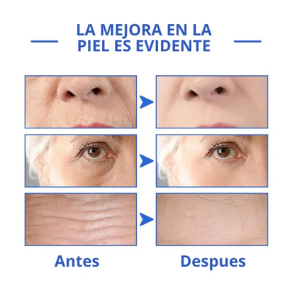 REJUVE21™ - Suero Antiarrugas